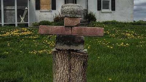 Third Degree Burns - Brampton, Ontario