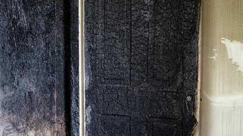 Third Degree Burns photo 5