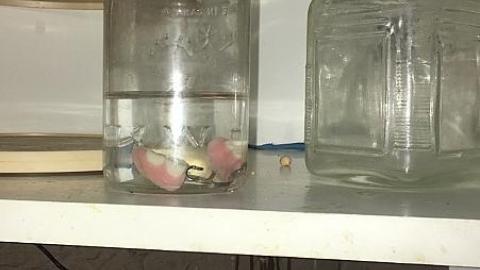 Forgot Your Teeth photo 3